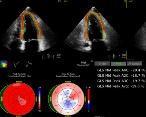 Ultrasound software application 