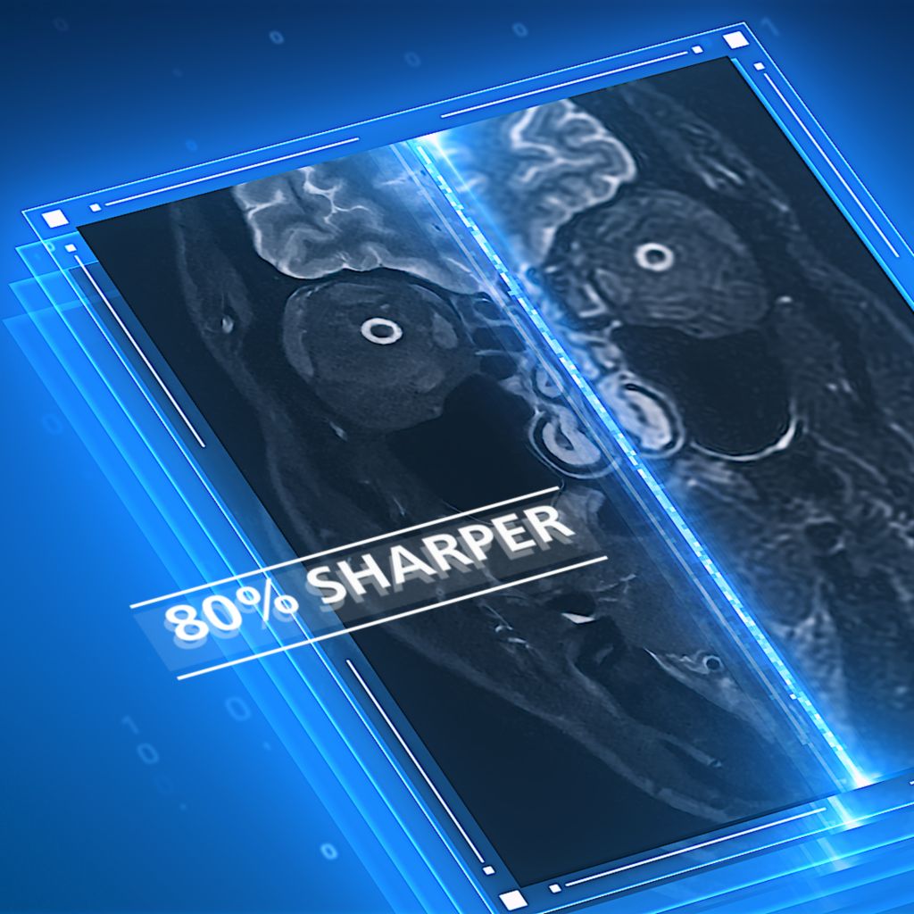 SmartSpeed Precise comparison