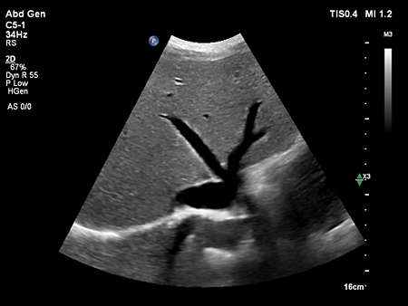 C5-1 Liver