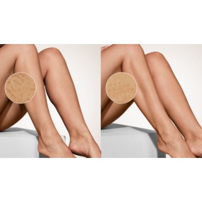 Lumea Sunstone Smart 9900 Feature Image (PPL) Visible and effective results,  B&A Legs