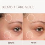 Younger-looking skin at home*