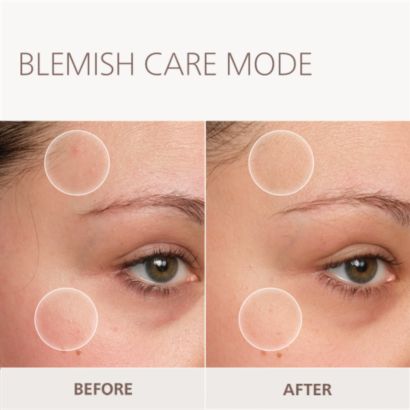 Younger-looking skin at home*