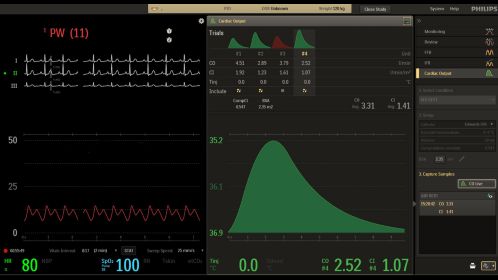 User interface - Cardiac output in the control room