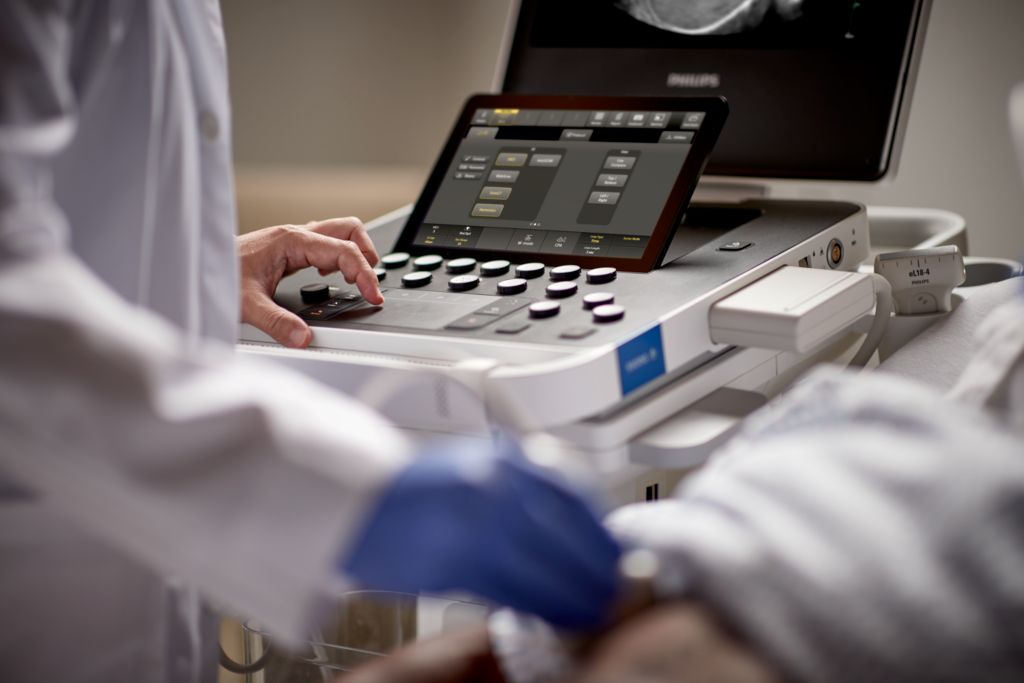 Compact Ultrasound System 5000 series GI with C5-1