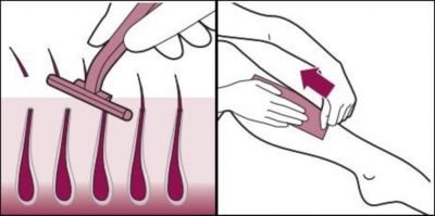 Removing hair from skin before using Philips Lumea