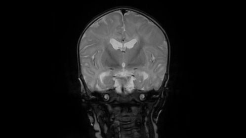 T1w IR (neonate)