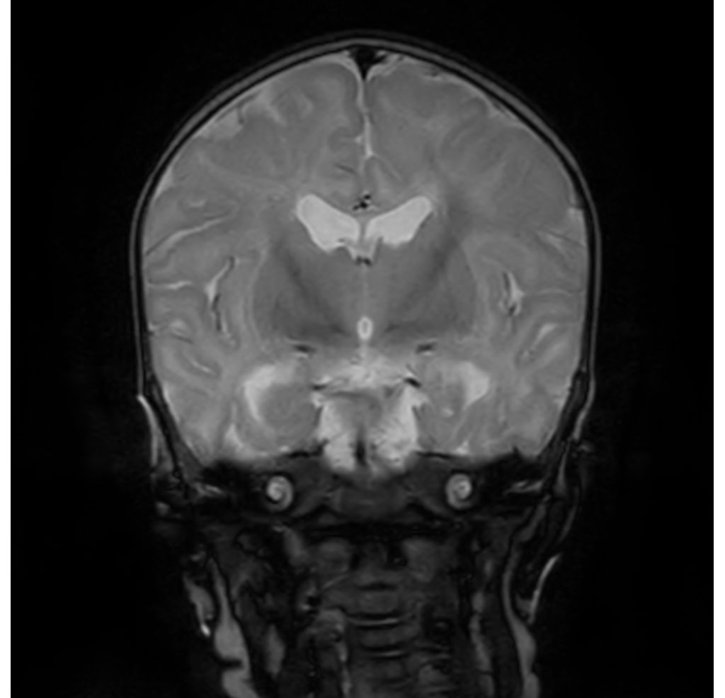T1w IR (neonate)
