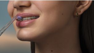 Great for your braces and brackets