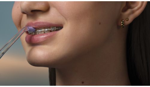 Excelent dacă ai aparate dentare şi brackeţi