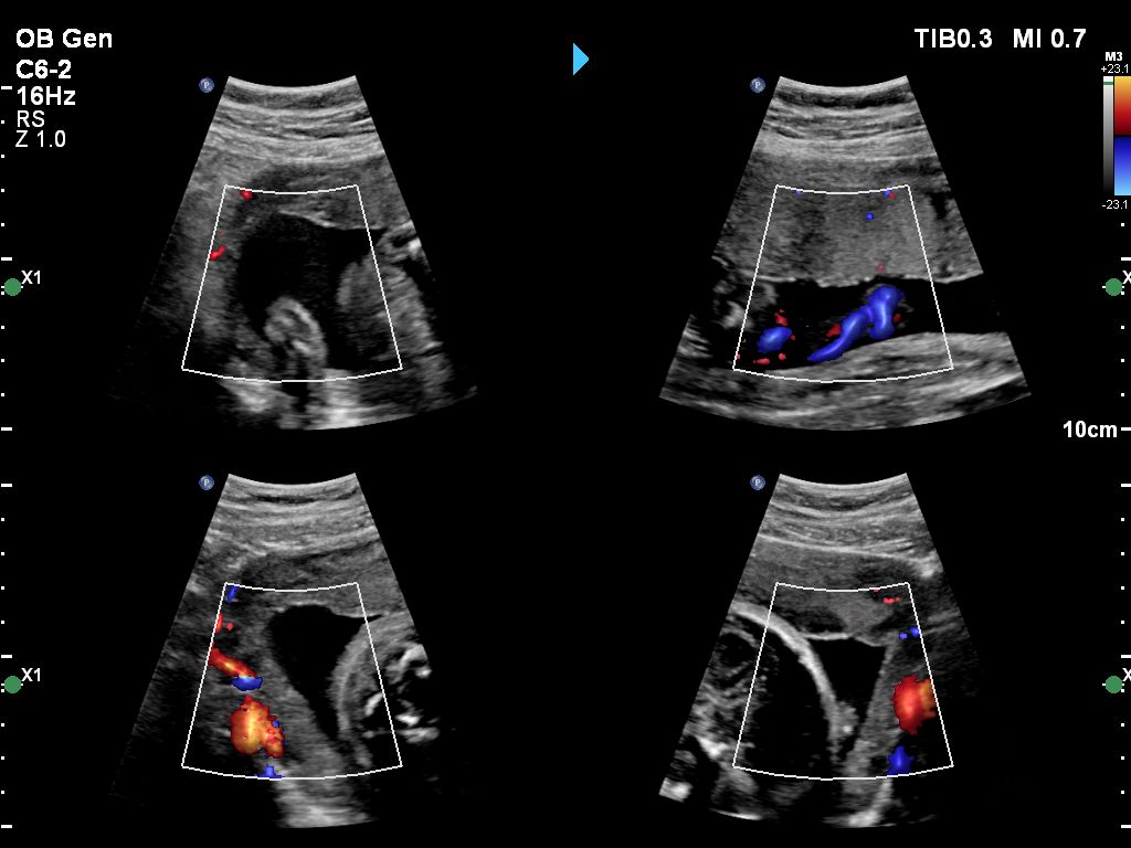 C6-2 OB GEN Affiniti Vm14 Quad color no measurements