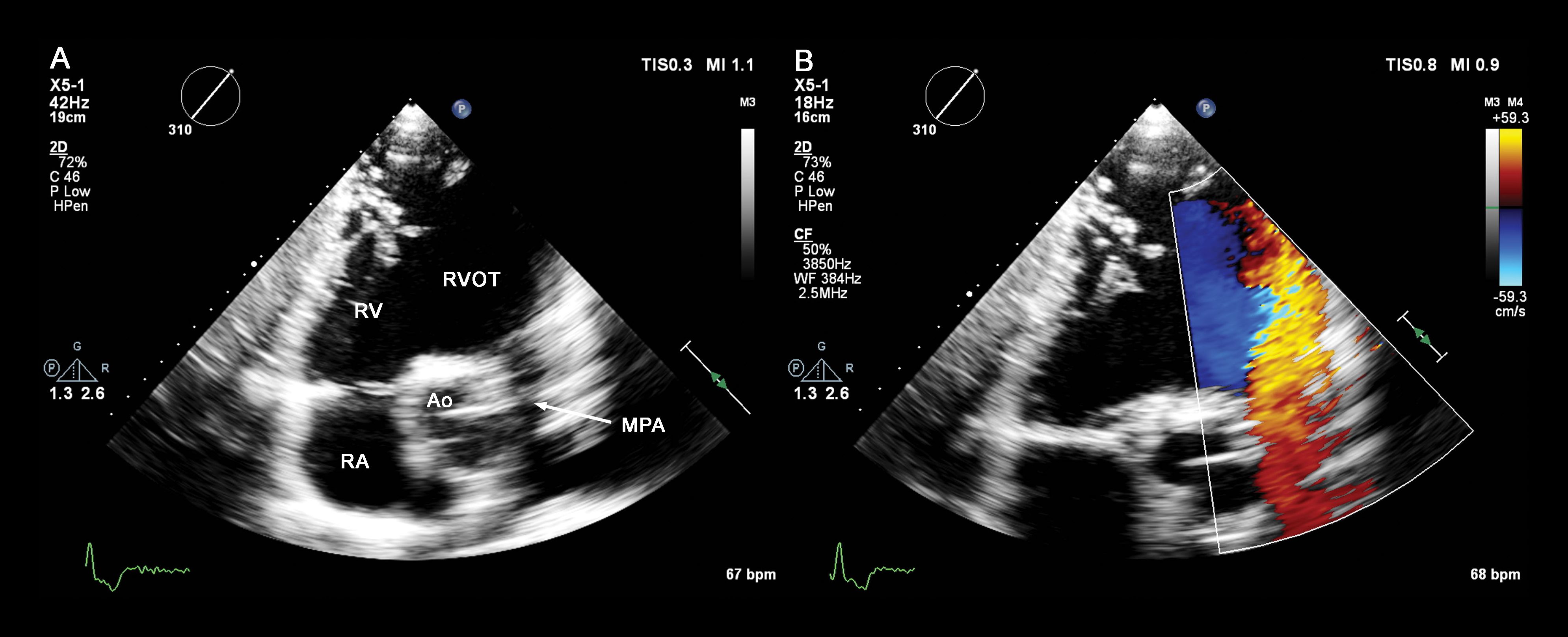 iRotate, CV Ultrasound