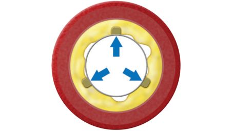 Power: ~15 – 25x scoring force