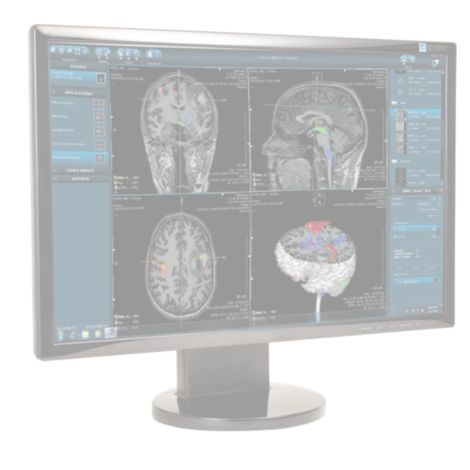 DynaSuite Neuro Advanced visualization for neuro analysis