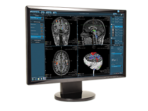 DynaSuite Neuro Visualización avanzada para análisis neurológico