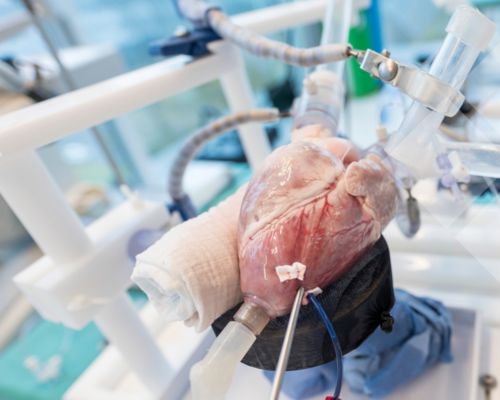 Philips Beating heart picture