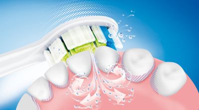Patented Sonicare toothbrush technology