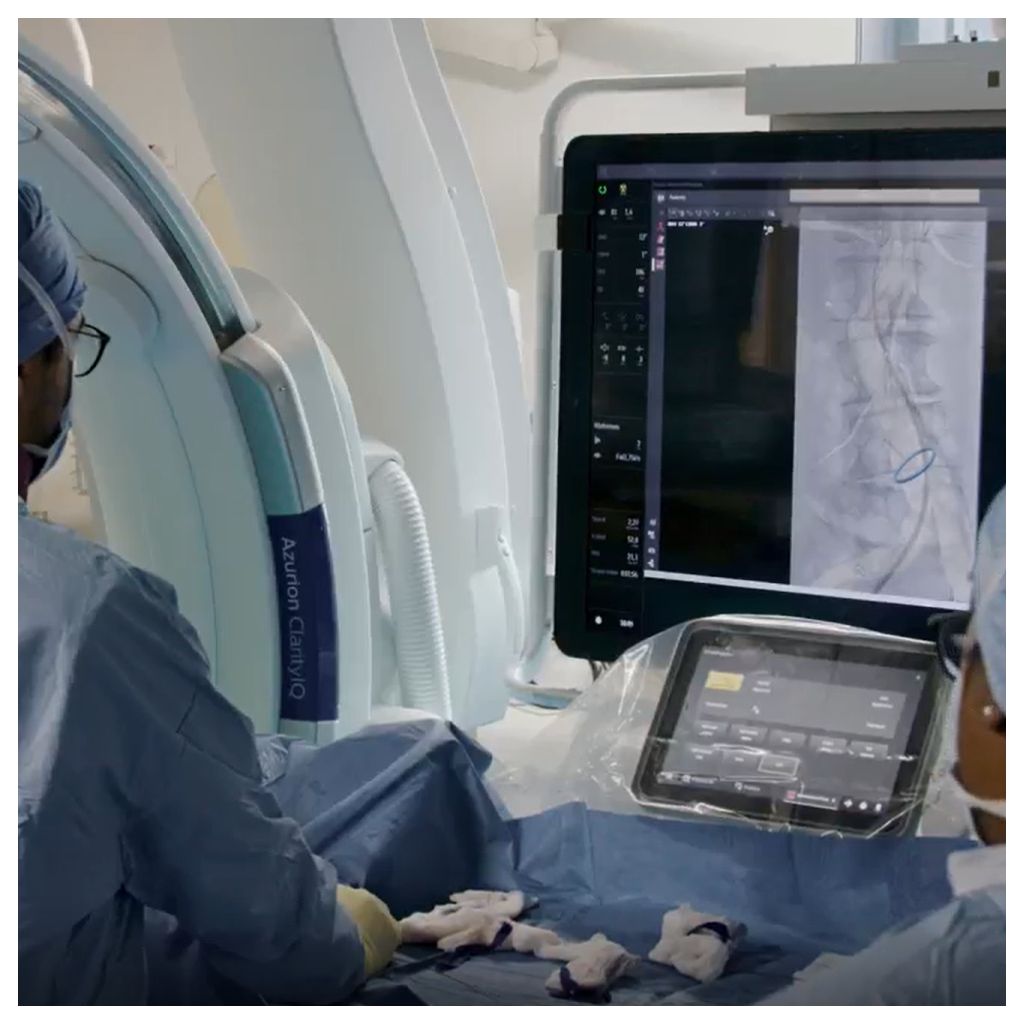 Doctors demonstrating the VesselNavigator technology