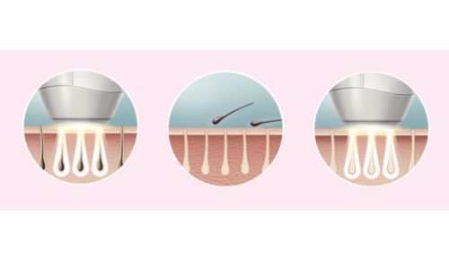 Pelle liscia ogni giorno