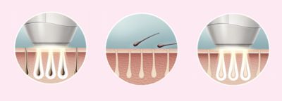 Enjoy smooth skin every day