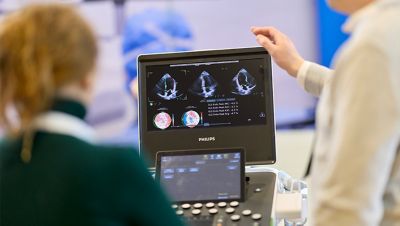 Медичний працівник демонструє систему кардіоваскулярного ультразвукового дослідження