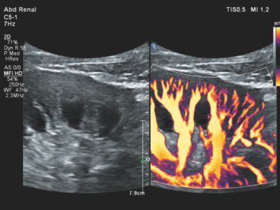 Ultraschall Web MFI