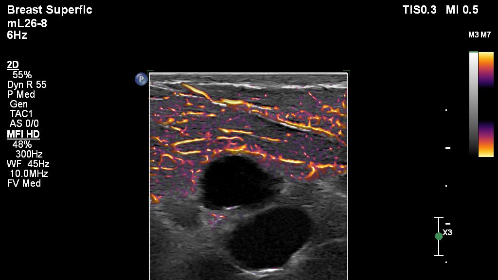 Breast Flow Viewer