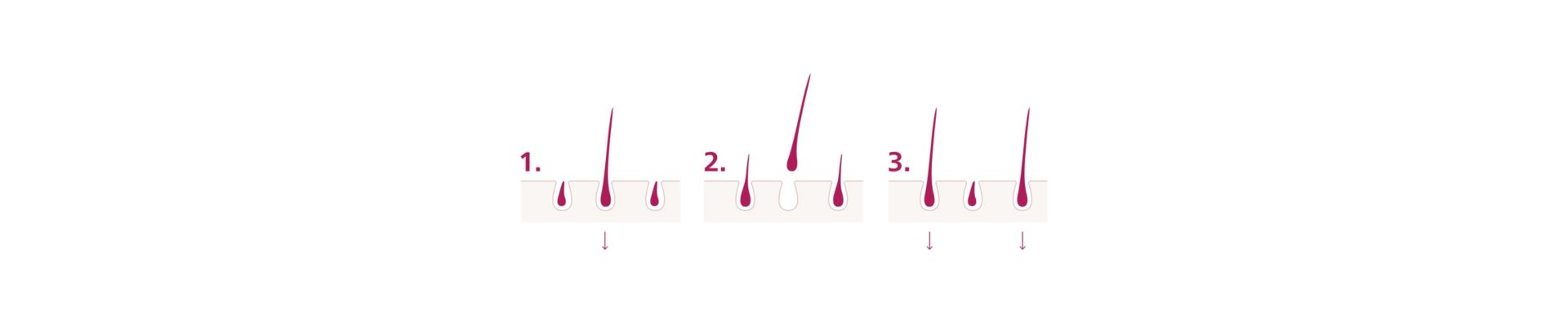 Защо отнема няколко седмици, за да се получи резултат?