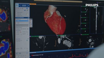 Cardiac image on screen