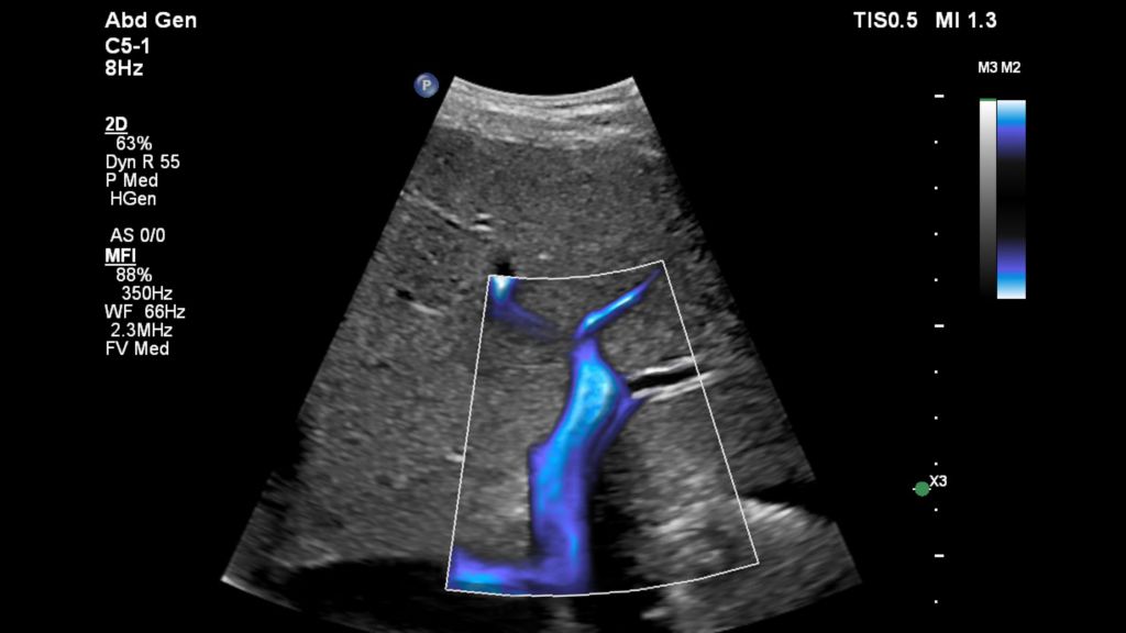 Liver IMage