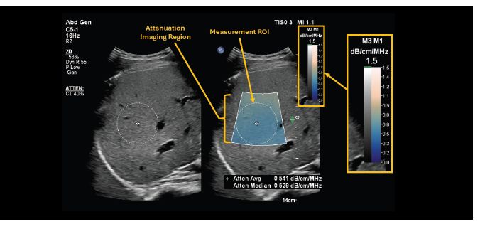 Graphic shows the display range and region for the attenuation image 