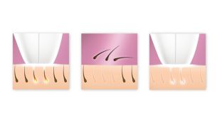 Enjoy smooth skin every day
