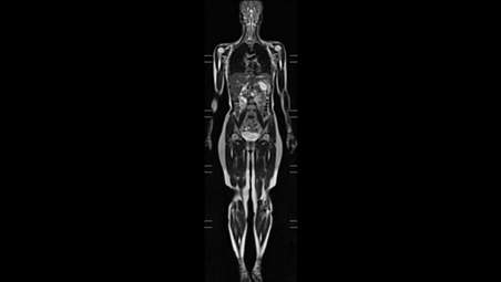 Whole-body MRI under 30 minutes