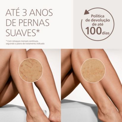 Philips Lumea IPL 7000