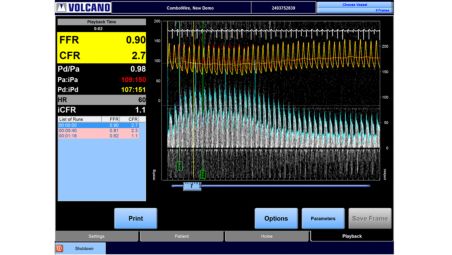 Pressure and flow velocity