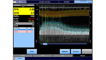 Pressure and flow velocity