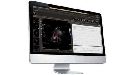 Internetbasierte echokardiographische Berichterstellung jederzeit und praktisch überall