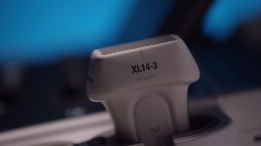 Датчик із фазованою решіткою x5 -1c xMATRIX