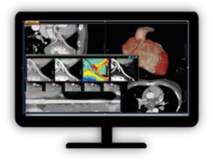 CT Spectral Comprehensive Cardiac Analysis Viewing and evaluation of cardiovascular CT images acquired on the Philips Spectral CT scanners