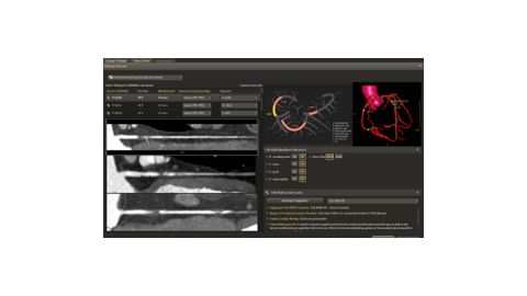 CT comprehensive cardiac analysis