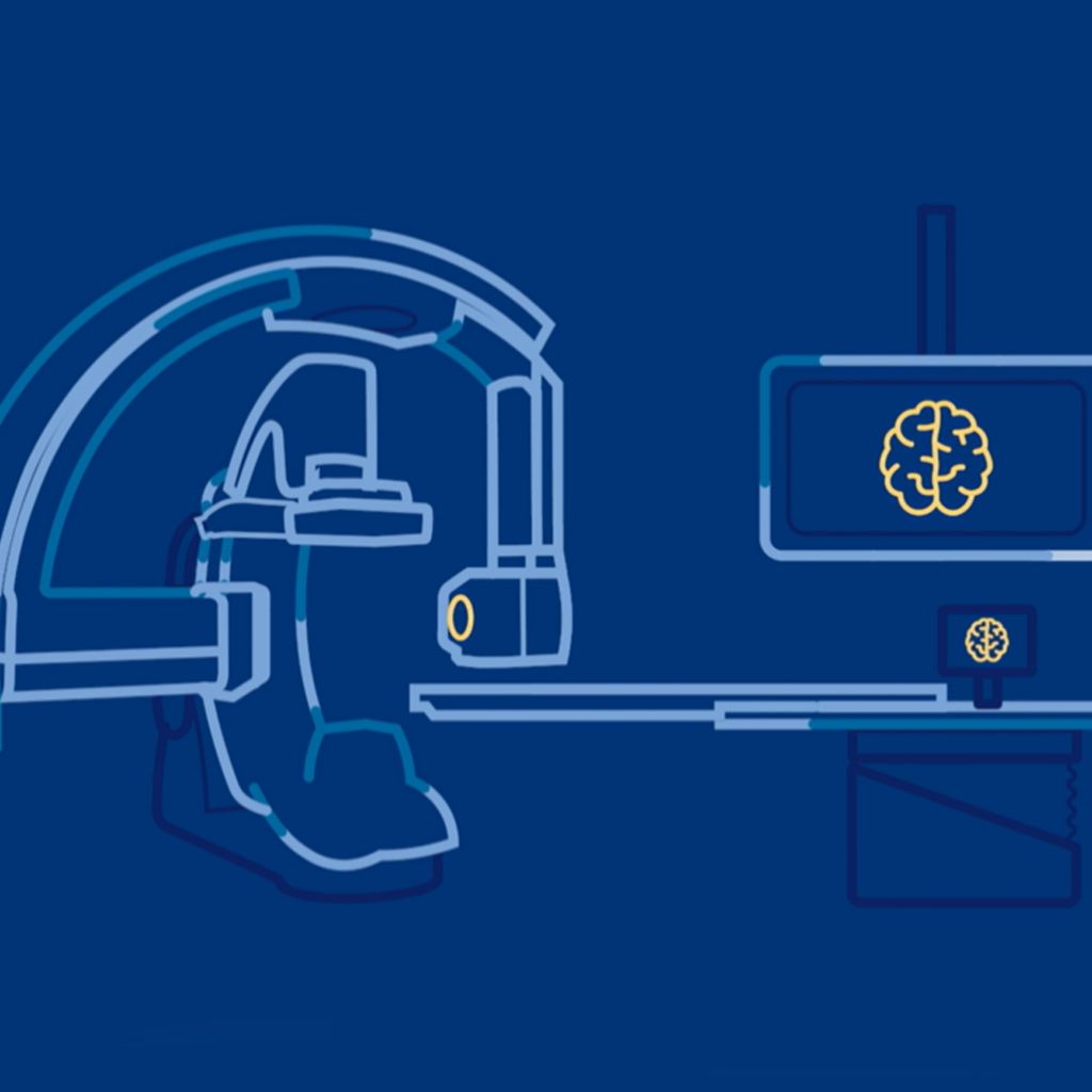 Direct to angio suite workflow