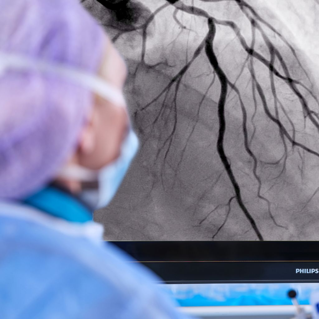 clinician analyzing coronary procedure with SmartIQ technology