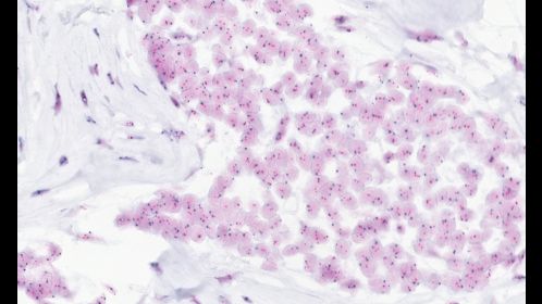 Clinical image digital pathology
