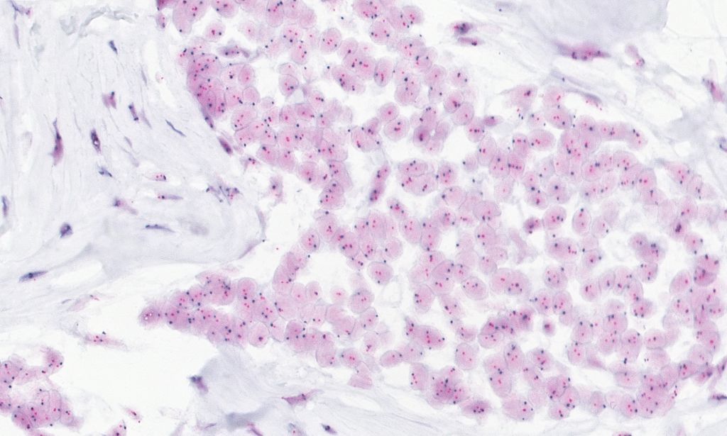 Clinical image digital pathology