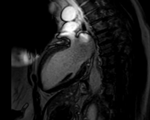 DynaCAD&nbsp;Prostate