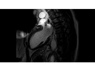 High Bandwidth IR MR Clinical applications