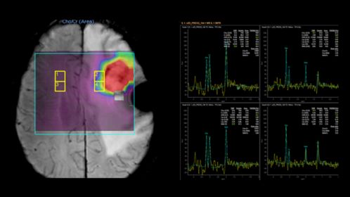 Spectroscopy Imaging
