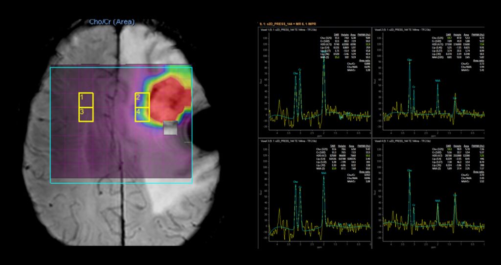 Spectroscopy Imaging