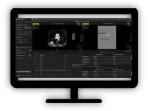 MR Qflow Visualizing and quantifying blood flow dynamics