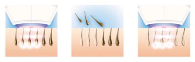 Uživajte v gladki koži vsak dan