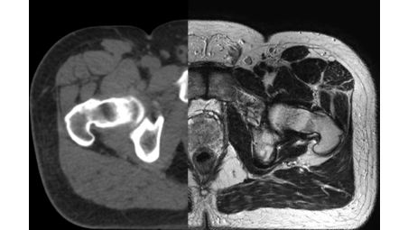 Experience the MRI difference